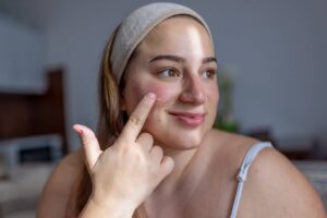 Les solutions naturelles pour mieux vivre avec le psoriasis au quotidien
