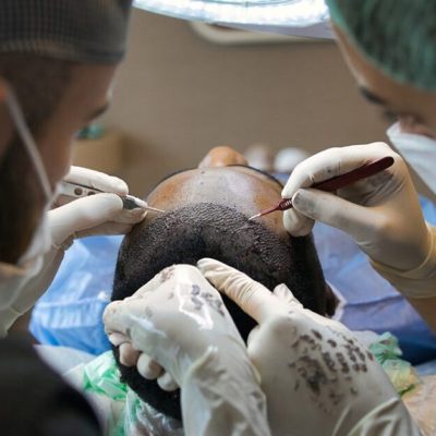 Dermopigmentation_capillaire_:_une_solution_efficace_pour_les_problèmes_de_calvitie_et_de_perte_de_cheveux
