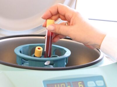 Monocytes_:_que_signifient_les_taux_élevés_et_bas_dans_une_analyse_de_sang_?